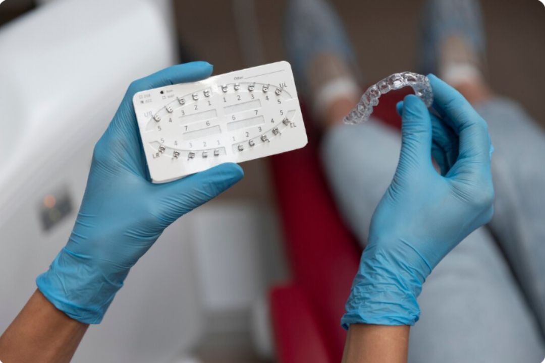  invisible aligners step by step treatment process